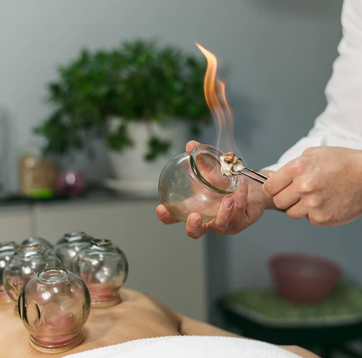 Hijama